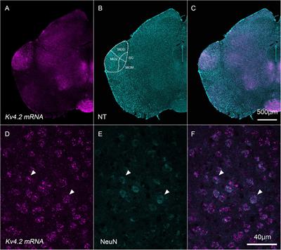 Kv4.2-Positive Domains on Dendrites in the Mouse Medial Geniculate Body Receive Ascending Excitatory and Inhibitory Inputs Preferentially From the Inferior Colliculus